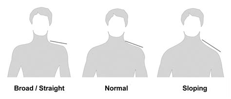 types of shoulder.